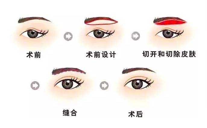 切眉.jpg