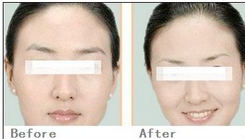 提眉術(shù)——趙小姐